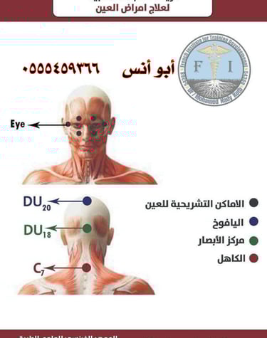 حجامه منزليه بمكه
