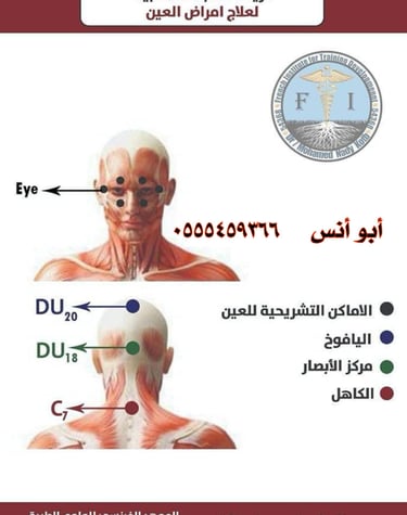 حجامه منزليه