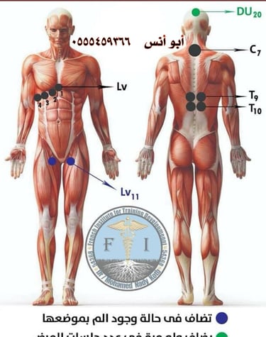 حجامه في مكة