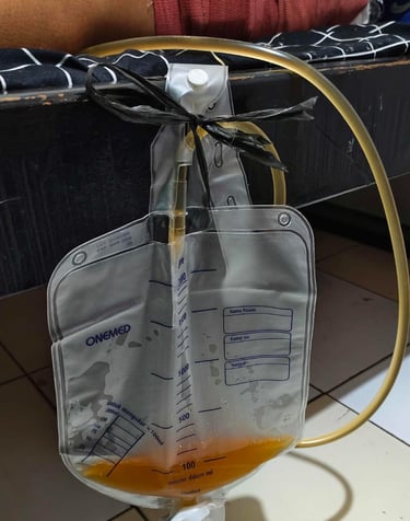 urine bag