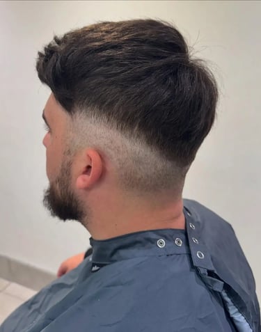 male hair loss clinic Hull  