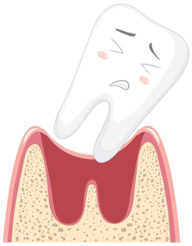 Récession gingivale jet dentaire ozone Aquolab hygiene-precision.com