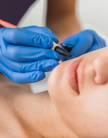 a woman getting electrolysis on her face for permanent hair removal