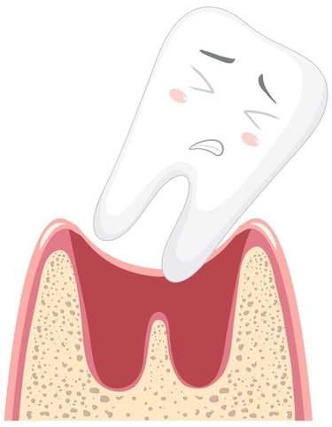 Récession gingivale jet dentaire ozone Aquolab hygiene-precision.com