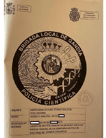 La policía científica de Gandía no supo o no pudo hacer su trabajo
