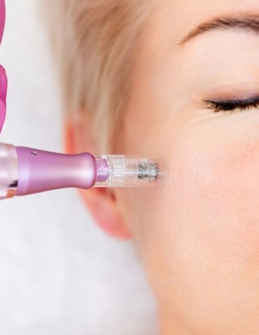 medicina estetica nina gaidau microneedling rovereto trento bolzano verona