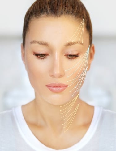 medicina estetica fili di trazione rovereto trento verona bolzano