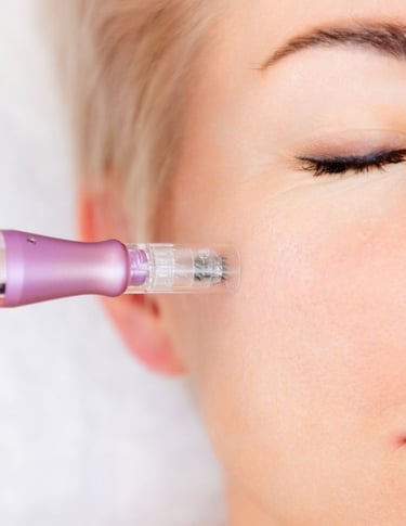 medicina estetica nina gaidau microneedling rovereto trento bolzano verona