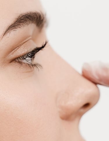 medicina estetica rinofiller rovereto trento