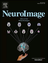Neural representations of imagined speech revealed by frequency-tagged magnetoencephalography respon