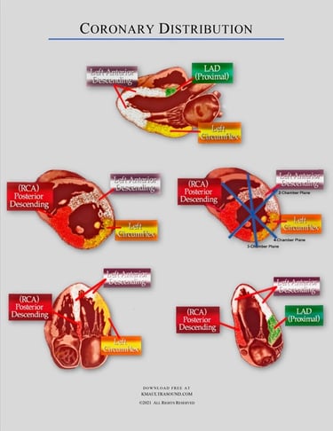 The heart-coronary artery distribution to regional walls.