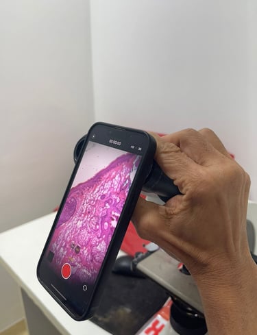 Registro de tumor e margens, Cirurgia Micrográfica de Mohs em Salvador, Bahia 