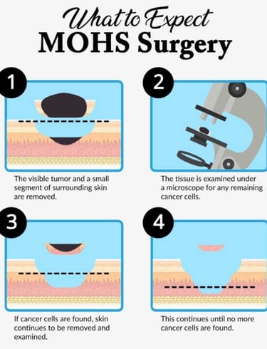 Mohs Surgery Highland Park, Dallas