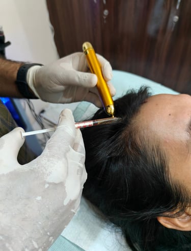 Dr. Bharat Agarwal, best plastic surgeon in Udaipur, performing advanced GFC PRP hair restoration treatment with precision