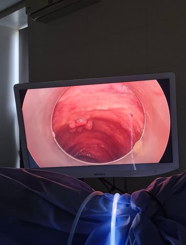 пухлина прямої кишки, ендоскопічне видалення новоутворення кишки, онкоколопроктолог, хірургія