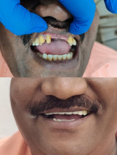 Veena Dental Care Virar