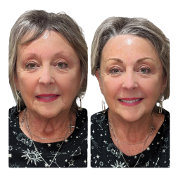 before and after picture of a woman with hair stroke eyebrows