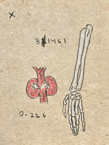 Rough sketch of the anatomy of the lower arm and kidneys and computer code