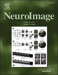 Wireless optically pumped magnetometer MEG