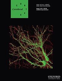 The Cortical Maps of Hierarchical Linguistic Structures during Speech Perception