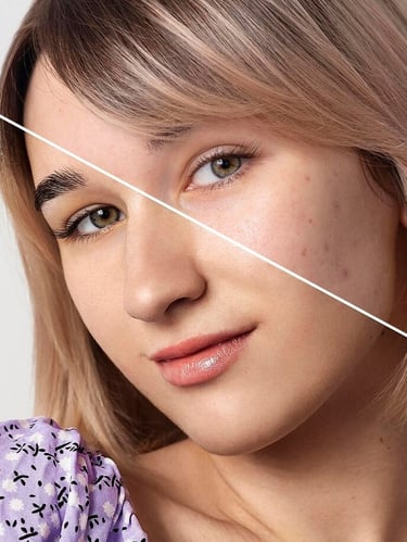 portrait-photo-retouching-skin-refinement