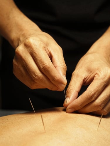 Hands-on clinical training, placing acupuncture needles with absolute precision under dramatic low-key lighting, warm gold highlights, deep black background, 35mm photography