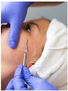 Dermaplaning Facial