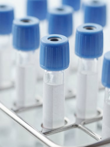 A macro close-up of clinical specimen vials in a sterile metal rack, bright high-key sterile light, cool white and slate blue tones, sharp focus, 35mm.