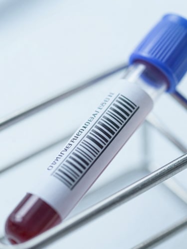 Macro close-up of a clinical blood sample vial in a metal rack, bright high-key sterile white light, cool blue undertones, sharp focus on the barcode label