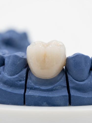 Macro close-up of a hand-finished ceramic crown on a stone model, bright clean clinical studio lighting, shallow depth of field, pristine white background, 4:5 vertical framing