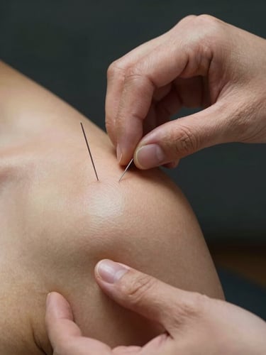 Close-up of hands-on physical therapy, precise placement of dry needles on a shoulder muscle under sharp clinical key light, dark background.
