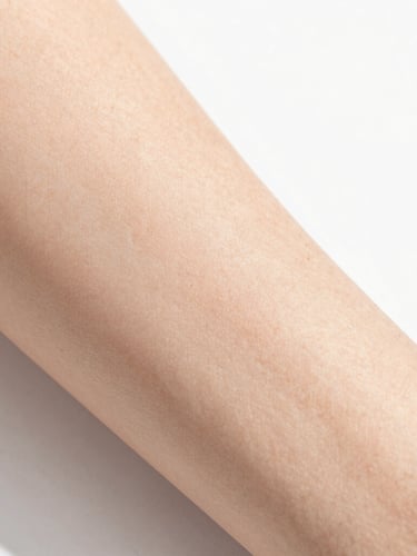 Clean clinical photography of real unretouched skin showing genuine healing, bright natural daylight, soft skin tones, macro depth of field