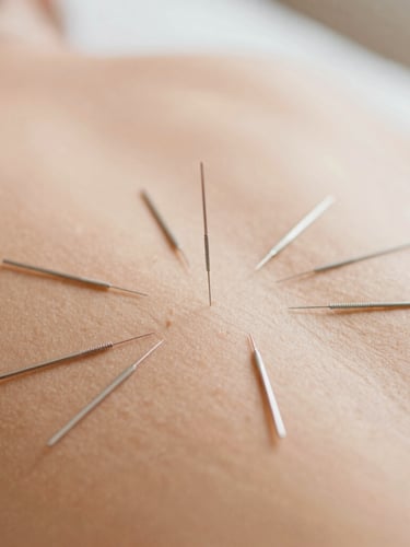 Close-up of acupuncture needles placed with clinical precision on a clean surface, warm terracotta tones, soft natural daylight, shallow depth of field