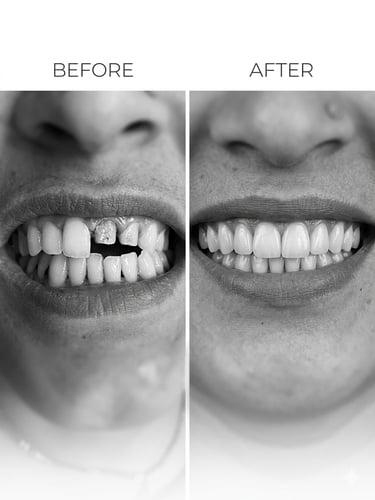 Veena Dental Care Virar