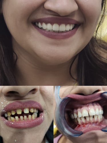 Veena Dental Care Virar