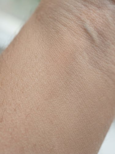 Macro clinical photography of clean healthy skin texture, bright natural daylight, soft shadows, neutral warm tones