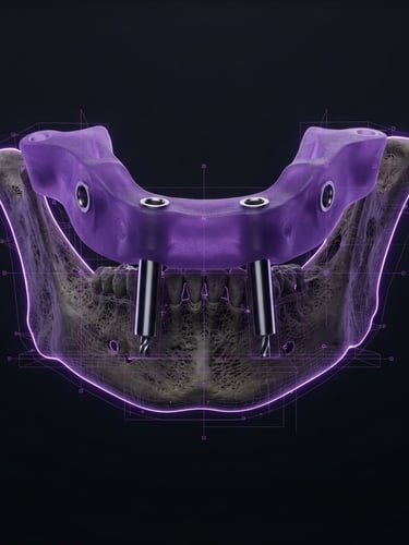 Orthographic 3D render of a high-precision surgical guide aligned over a digital bone model, royal purple neon edge-lighting, deep obsidian background, macro view