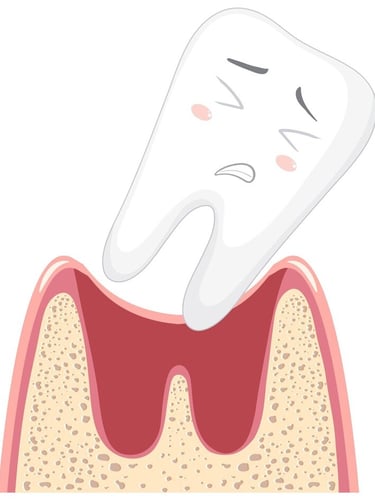 Receding Gums hygiene-precision