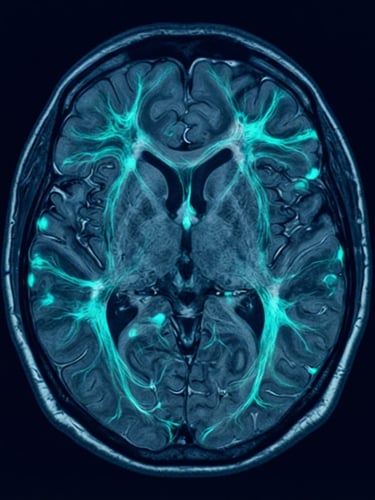 High-contrast clinical medical photography of an fMRI brain scan, deep navy background with glowing teal neural pathways, sharp focus, 35mm