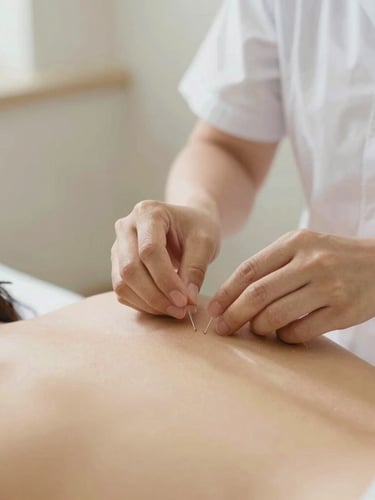 A vertical portrait shot of a licensed practitioner's hands carefully placing sterile acupuncture needles on a patient's back, warm sand tones, soft focus background, clean clinical setting, 35mm.
