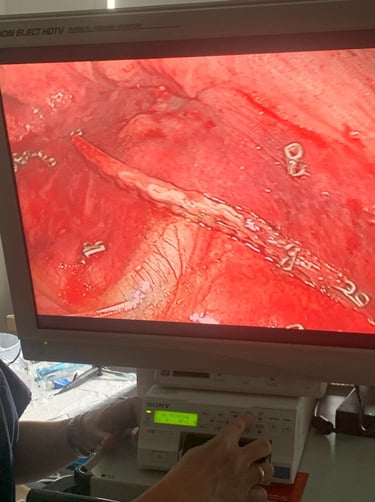 Expert specialist lung surgeon Malta