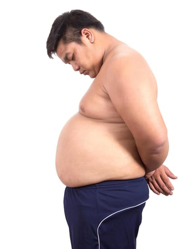 homme gros ventre surpoids obese
