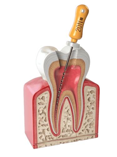 a toothbrush and a toothbrush in a dental device
