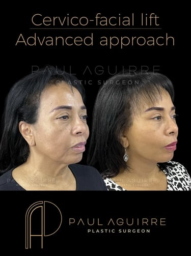 Cirujano plástico de cara Bogotá | Lifting