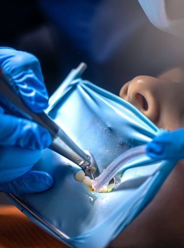Procedimiento de endodoncia con tecnología especializada en DUPRINS Lima - Tratamiento de conducto