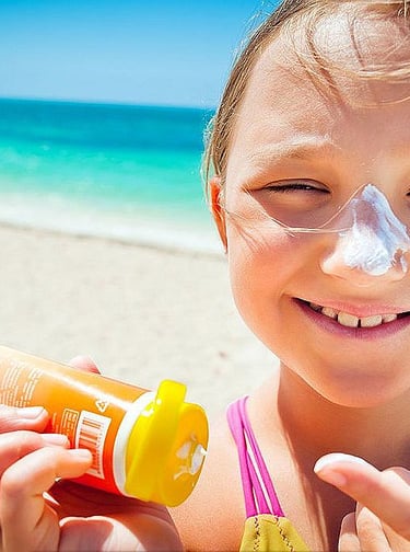 Dealing with Sunburns