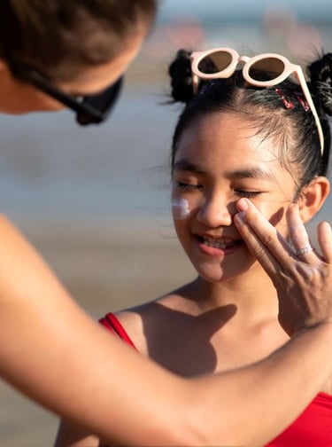 Dealing with Sunburns