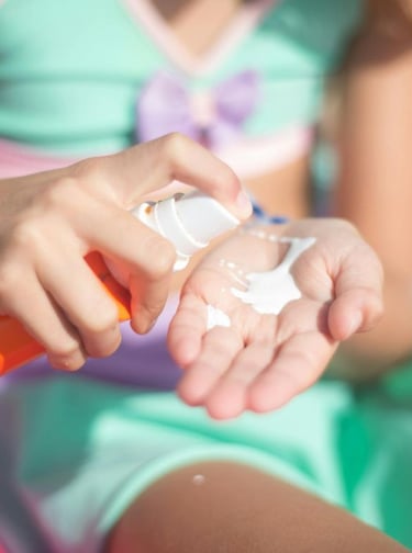 Dealing with Sunburns