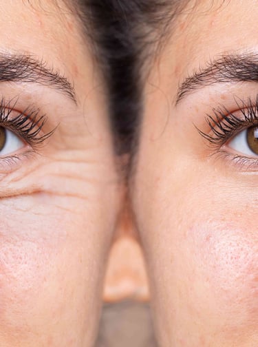 جراحات تجميل وتكميل العين