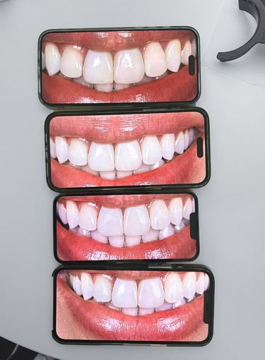 mobile dental photography comparison